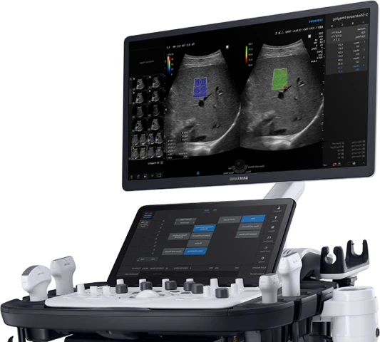 ultrasound-scan